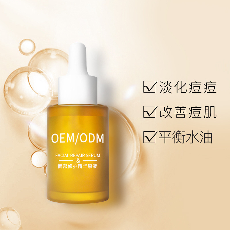 唯瑅_祛痘精华原液OEM